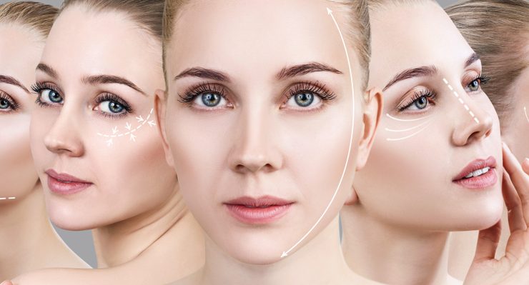 Deep Plane Facelift Recovery, What to Expect