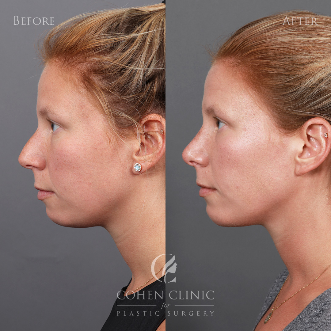 Case 45676 Marge Image