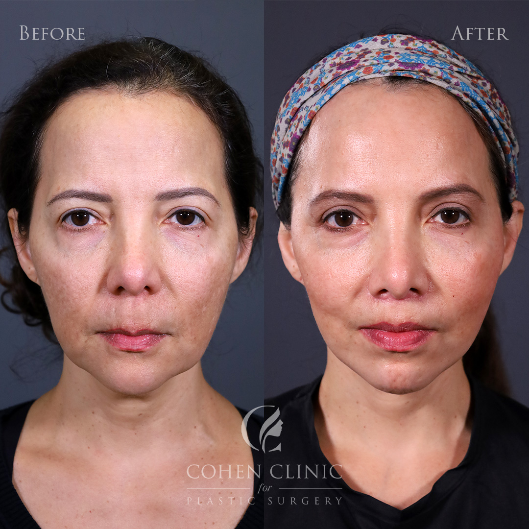 Case 34555 Marge Image