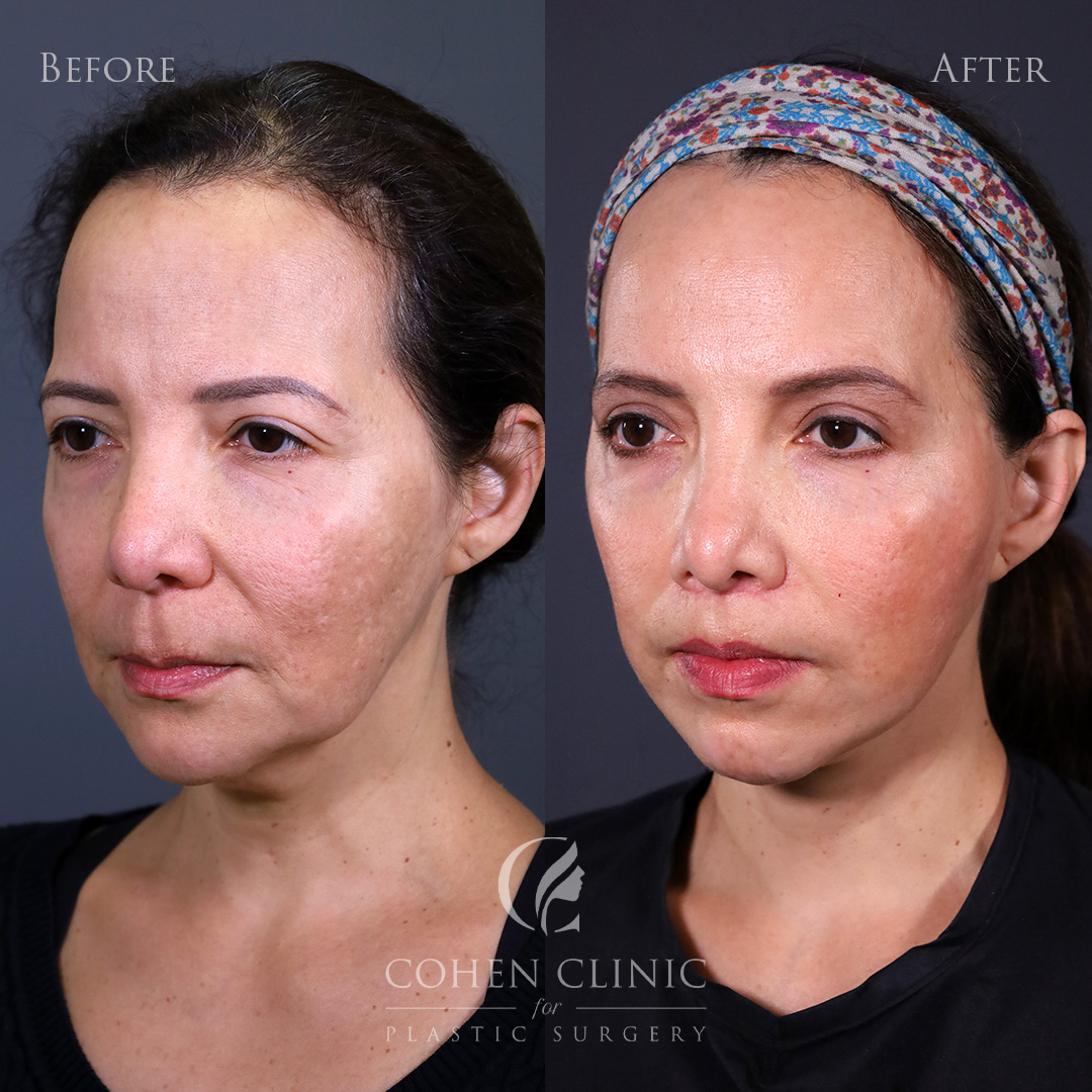 Case 34555 Marge Image