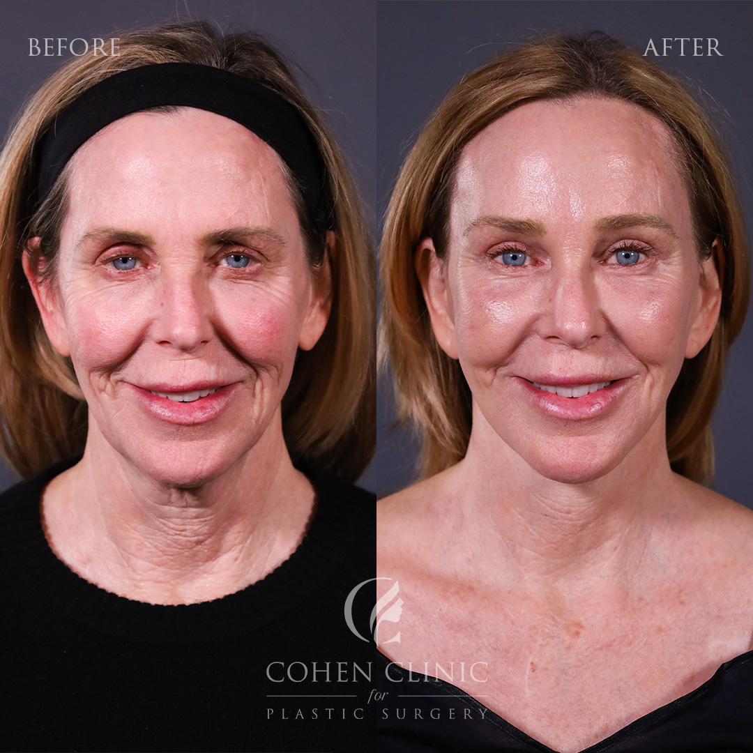 Case 18235 Marge Image