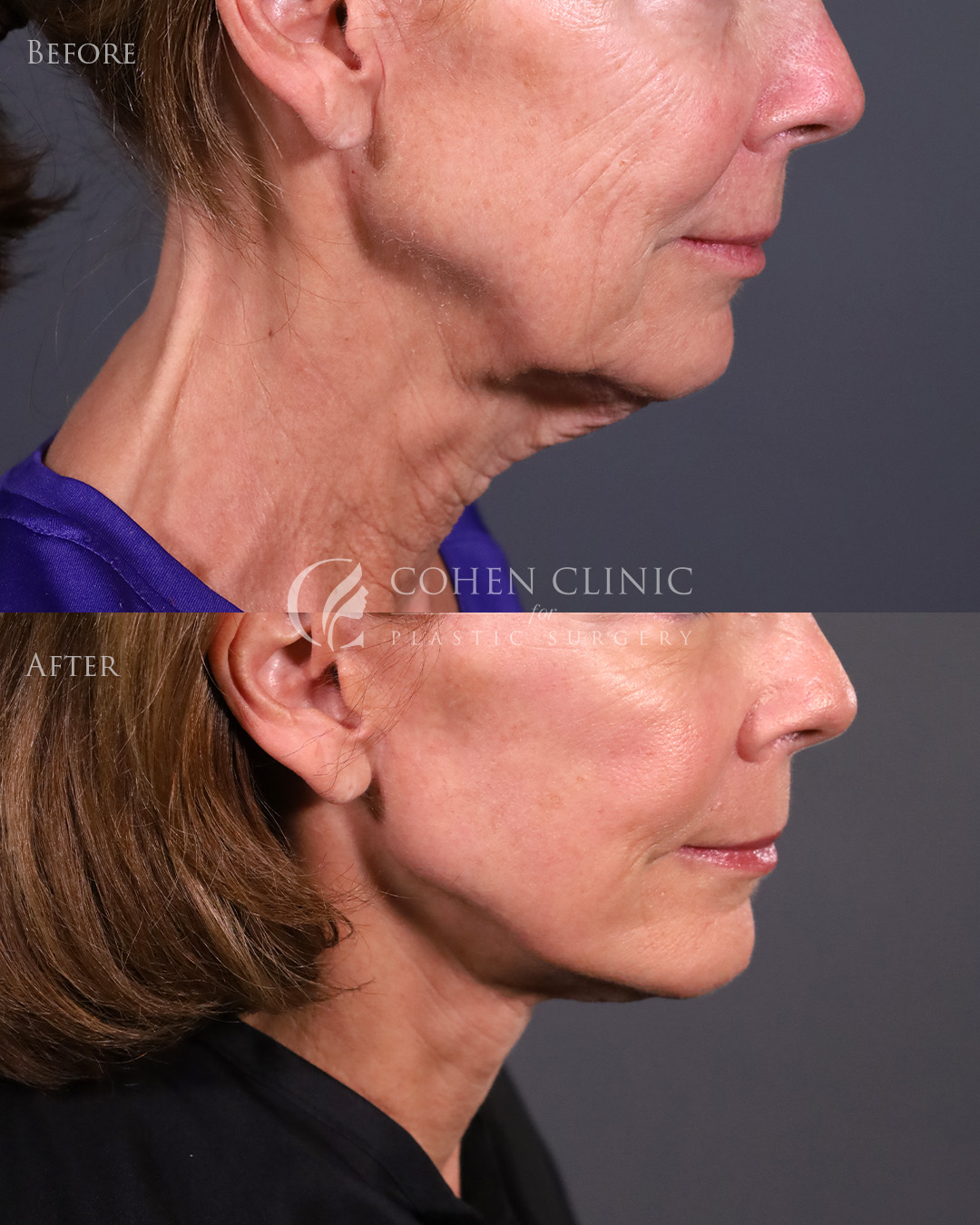 Case 22322 Marge Image