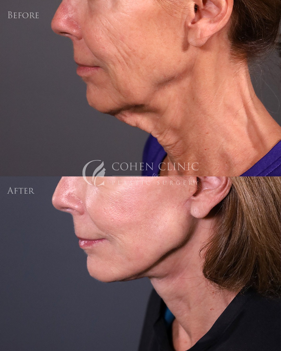 Case 22322 Marge Image