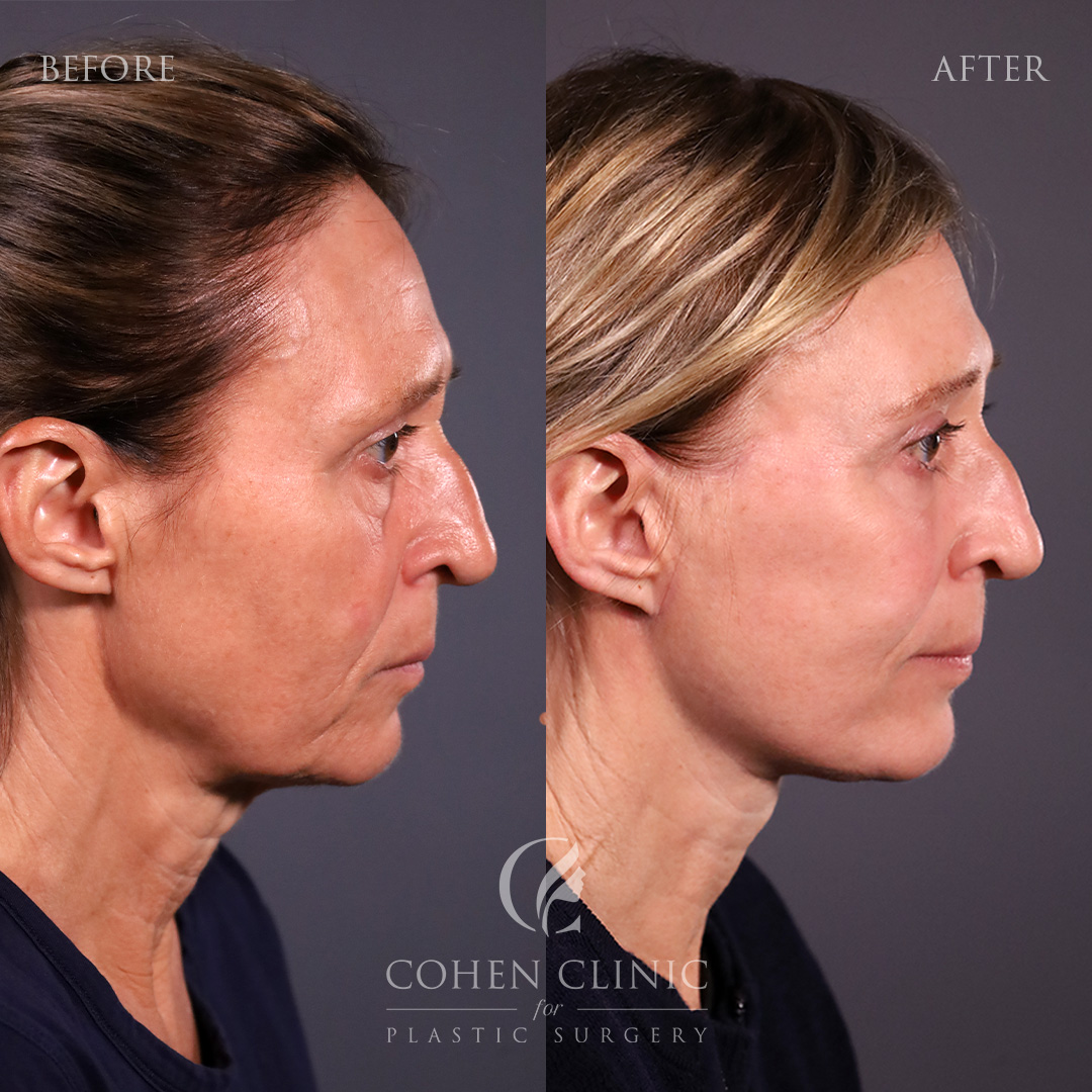 Case 45632 Marge Image