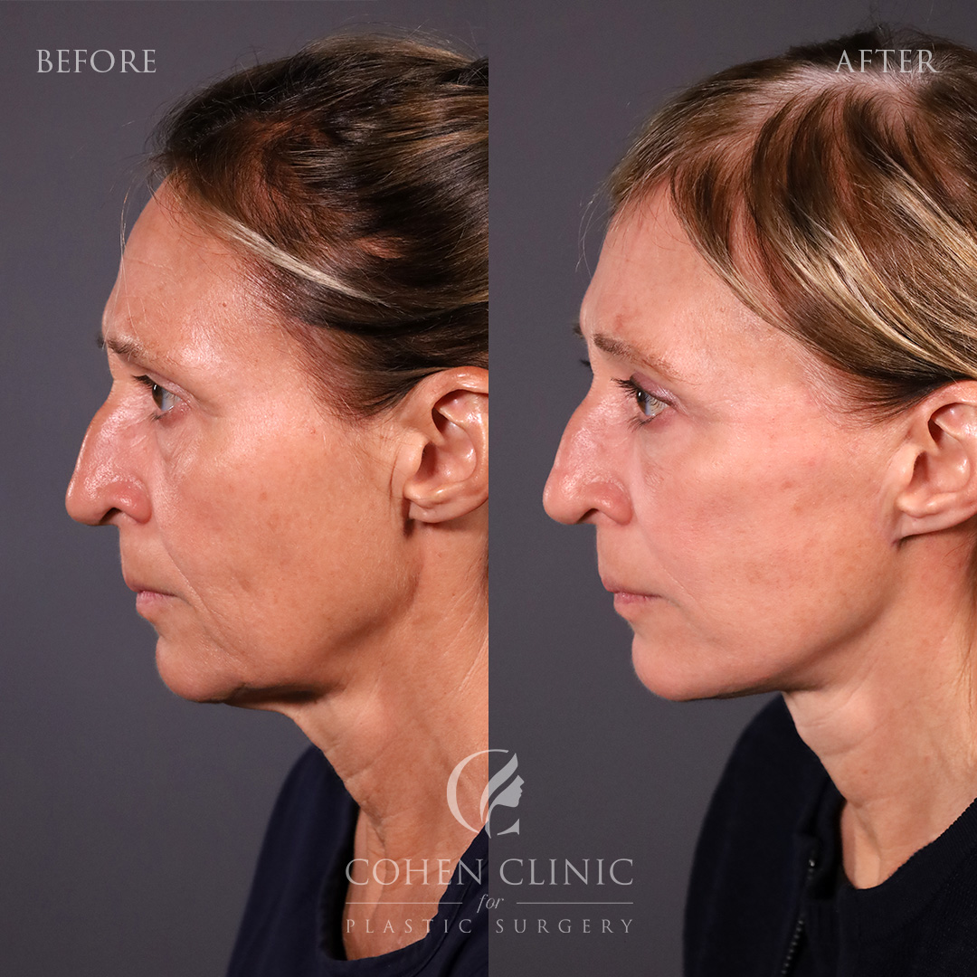 Case 45632 Marge Image