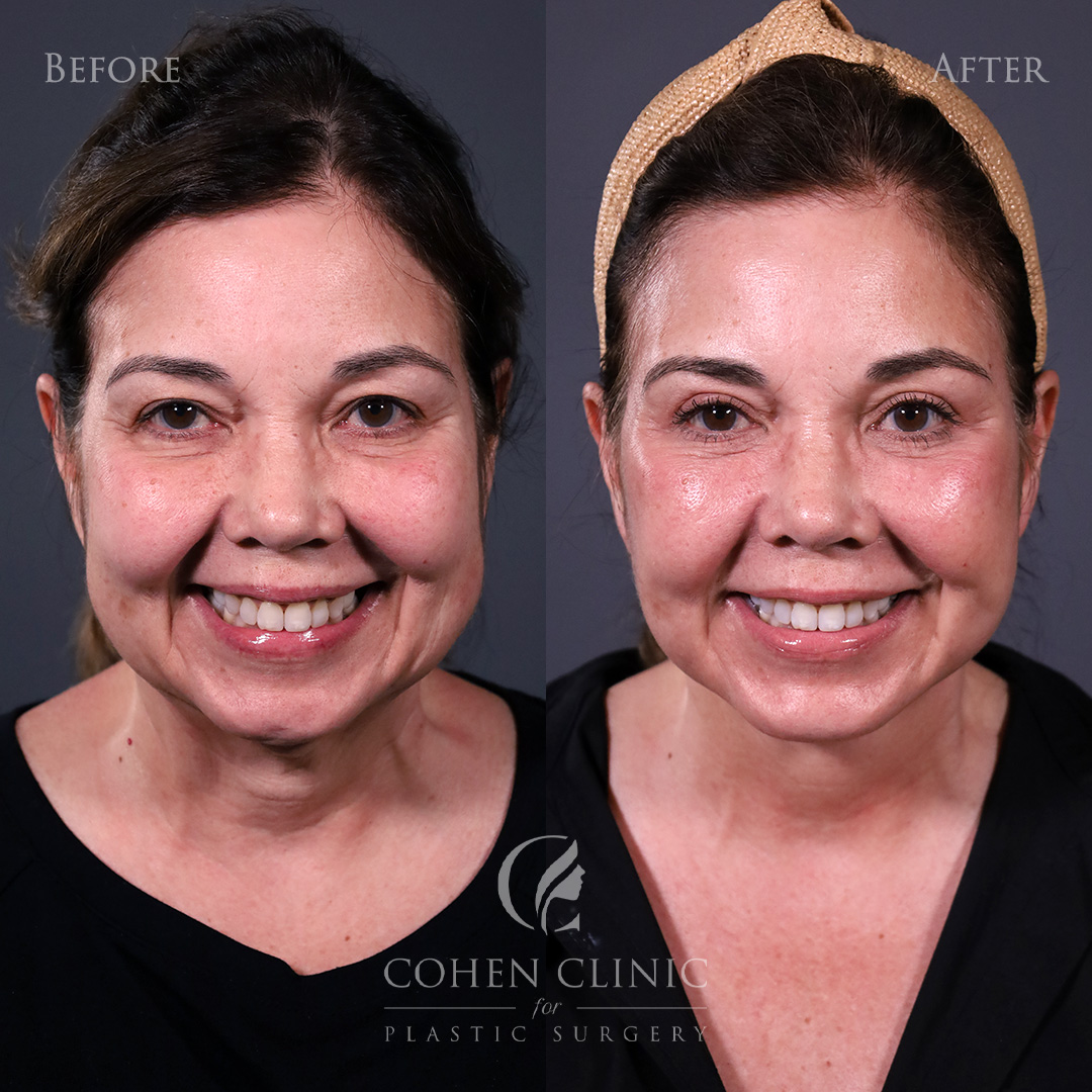 Case 56655 Marge Image