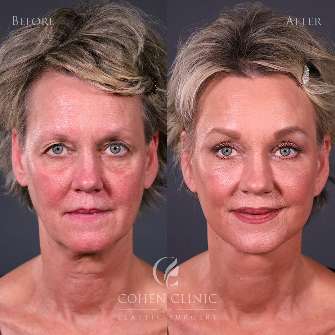 Case 34522 Marge Image