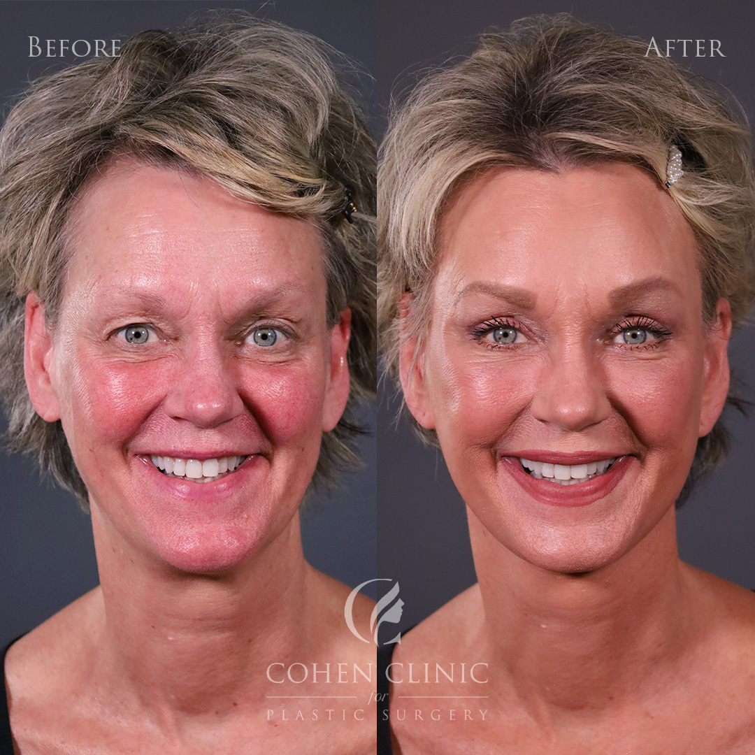 Case 34522 Marge Image