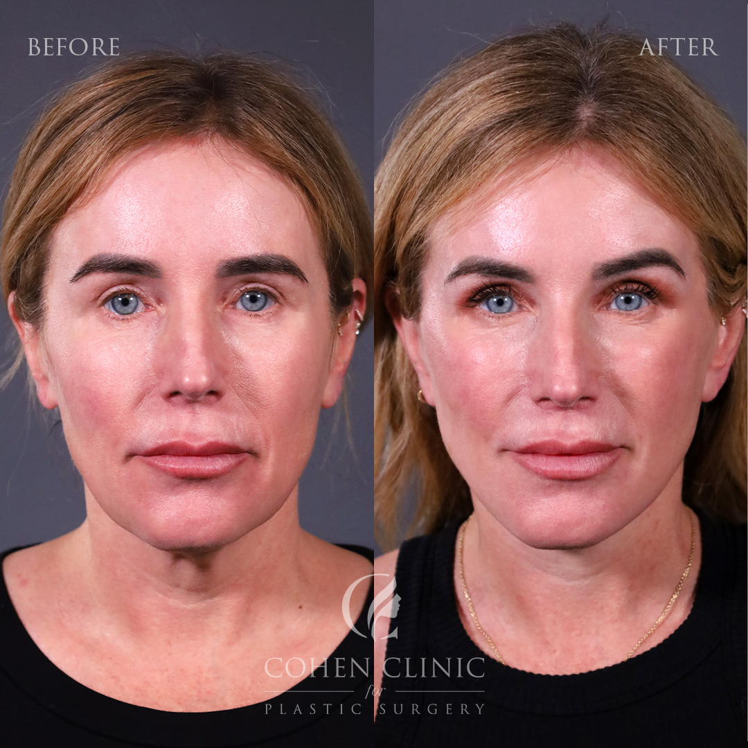 Case 77789 Marge Image