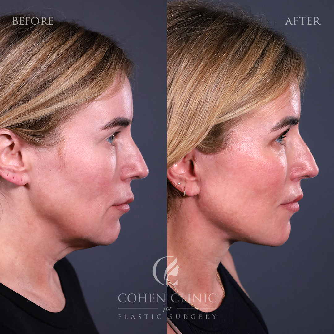 Case 77789 Marge Image