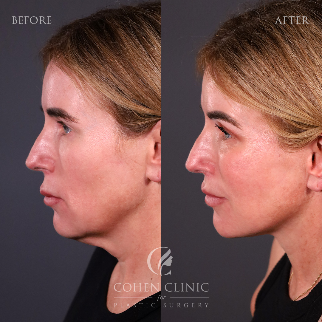 Case 77789 Marge Image