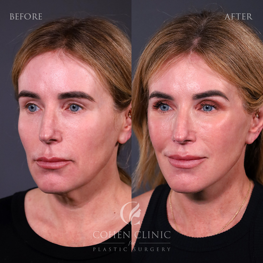 Case 77789 Marge Image