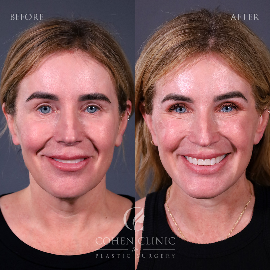 Case 77789 Marge Image