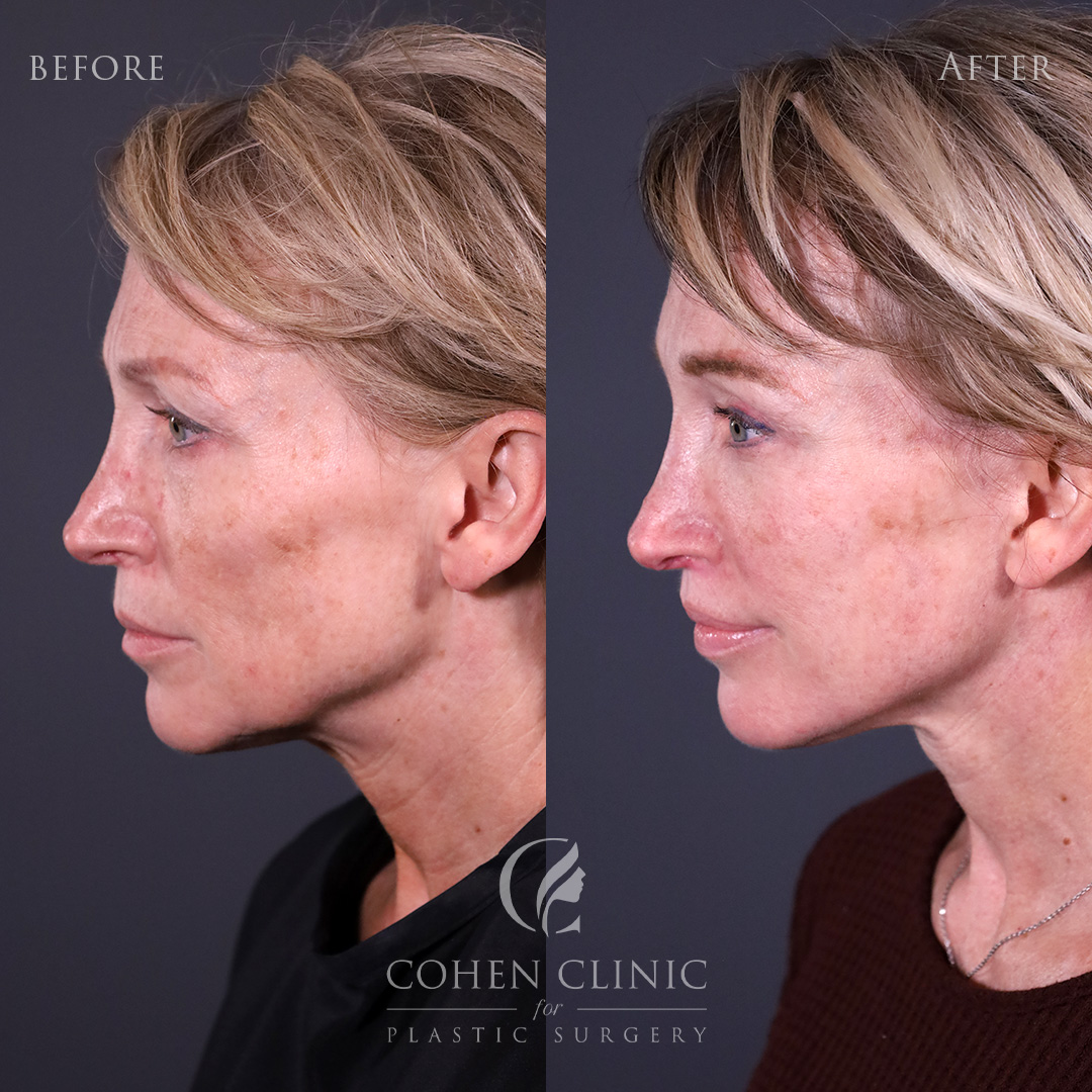 Case 22356 Marge Image