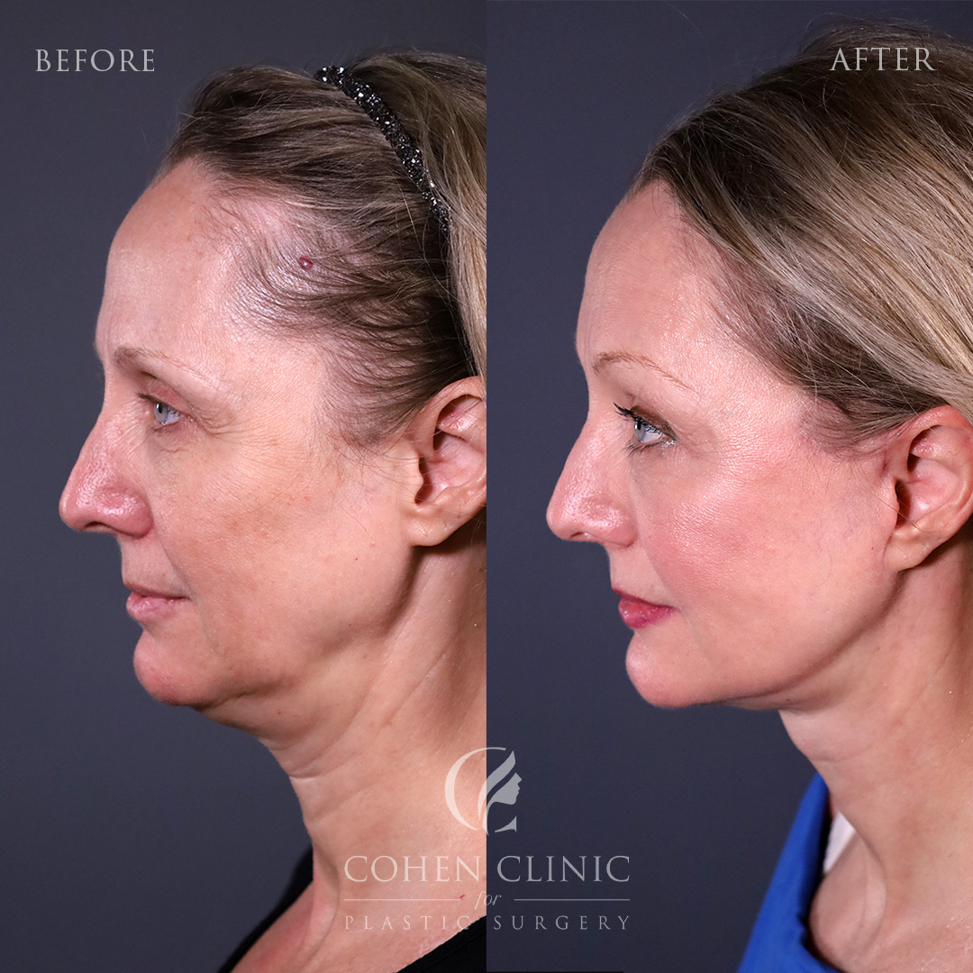 Case 67779 Marge Image