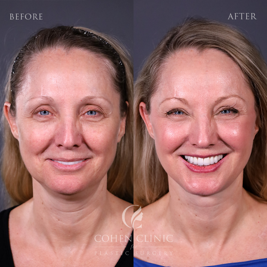 Case 67779 Marge Image