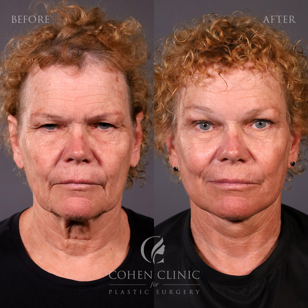 Case 89455 Marge Image