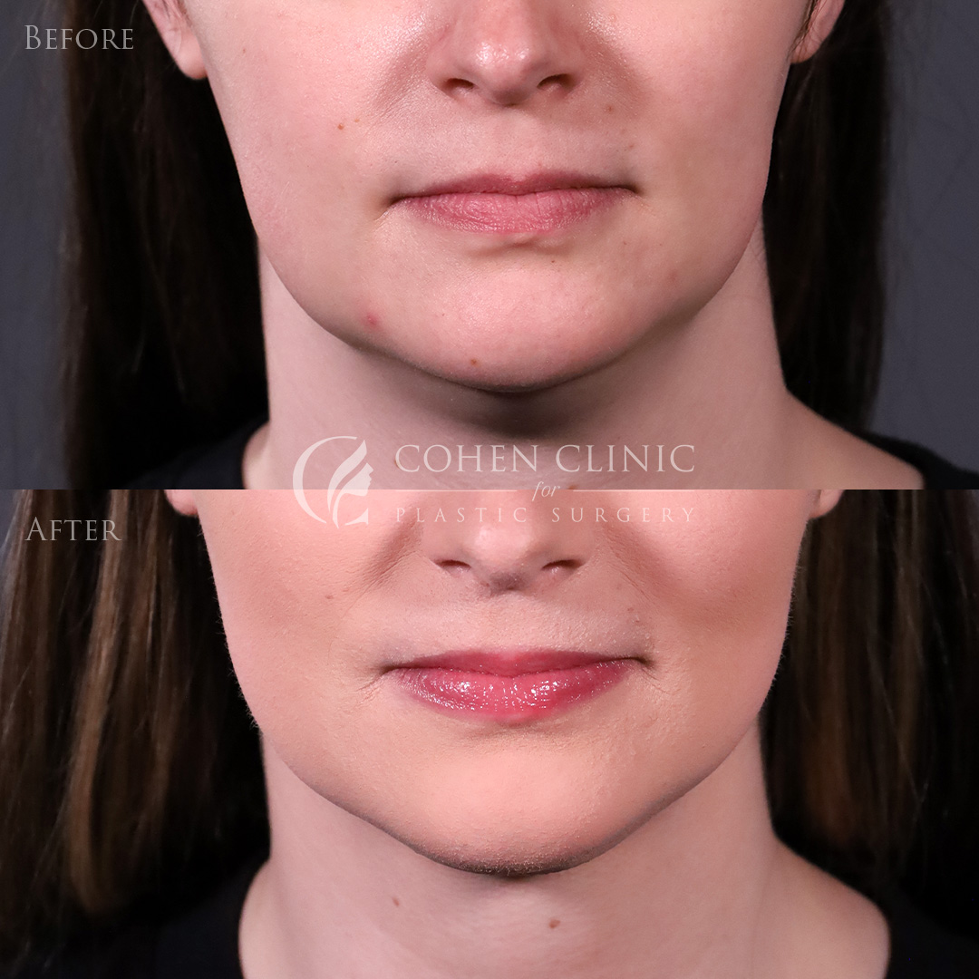 Case 98004 Marge Image