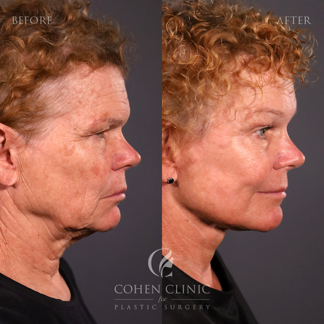 Case 89455 Marge Image