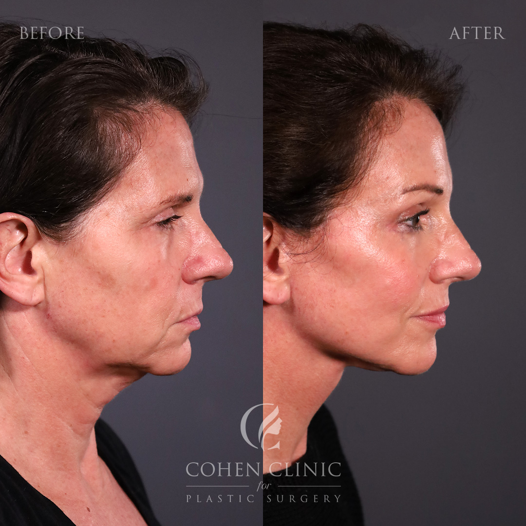 Case 76229 Marge Image