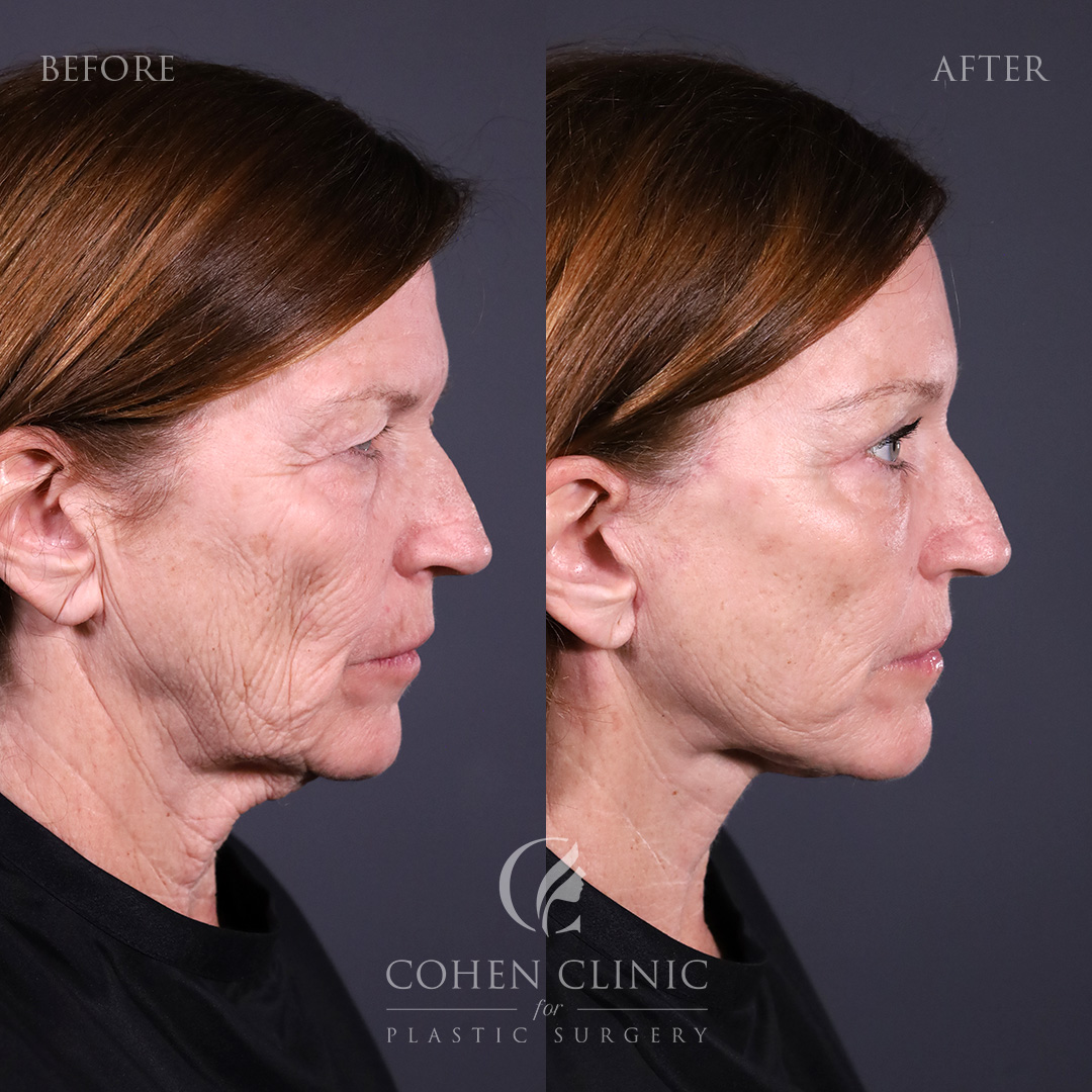 Case 65771 Marge Image