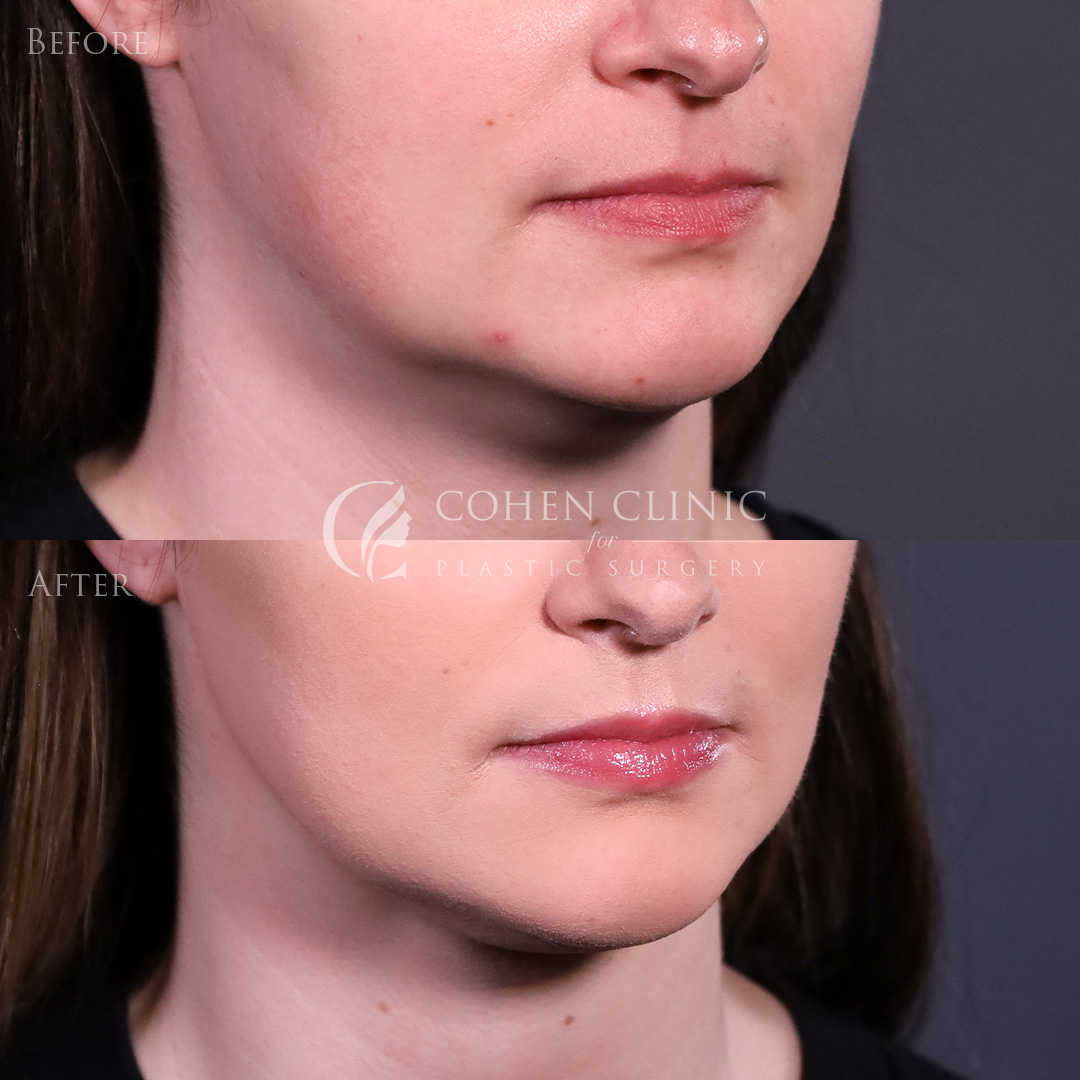 Case 98004 Marge Image