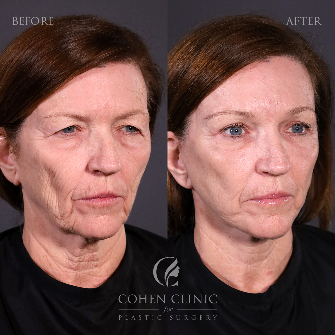 Case 65771 Marge Image