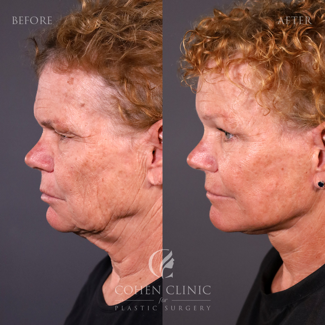 Case 89455 Marge Image