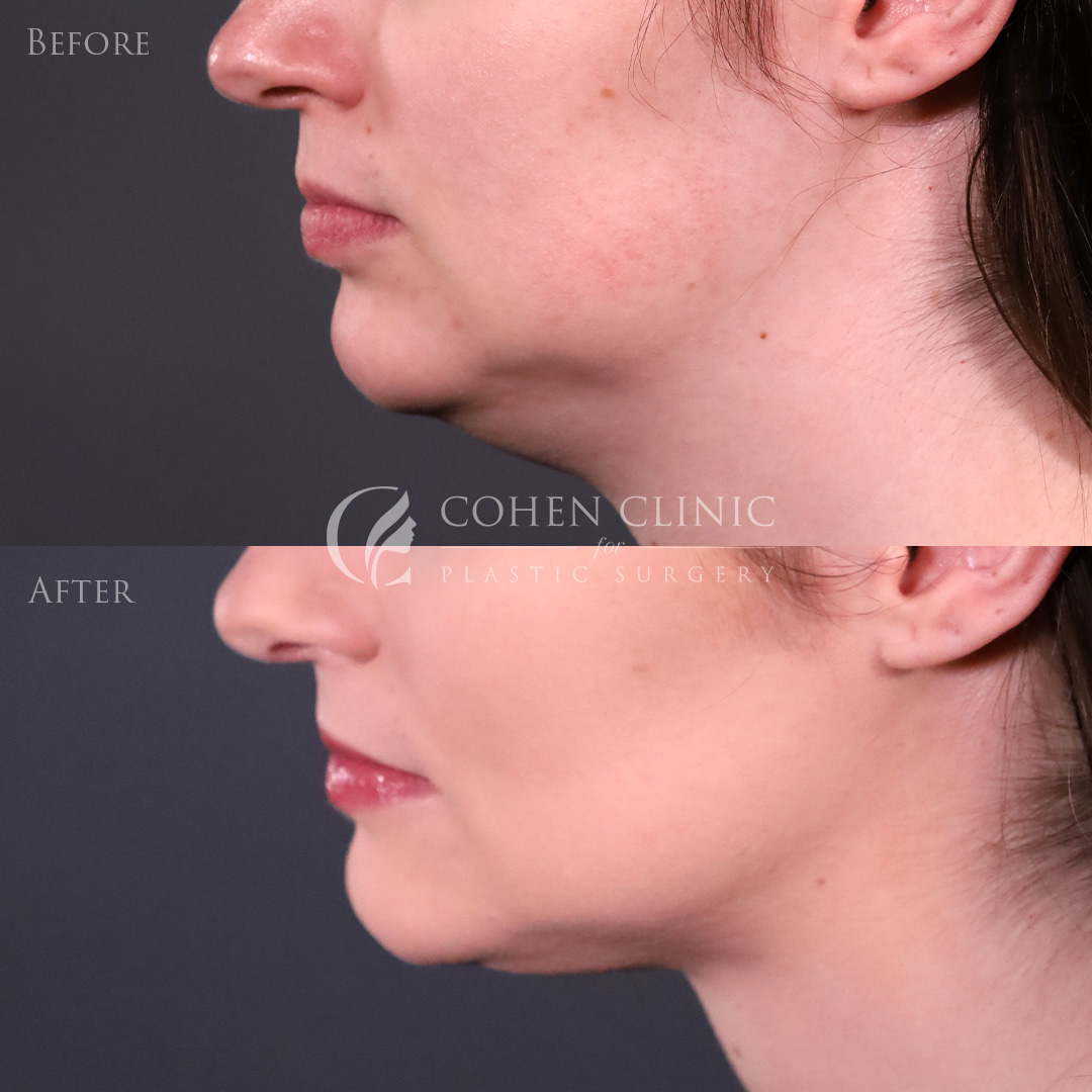 Case 98004 Marge Image