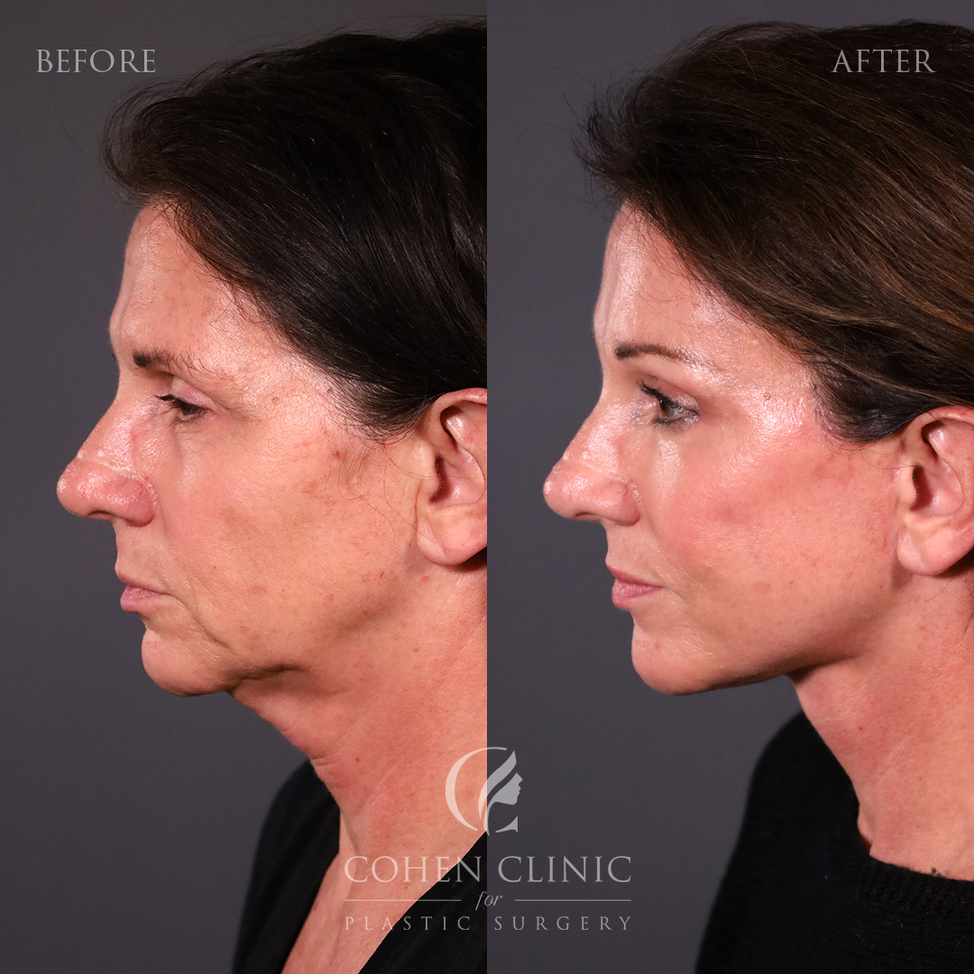 Case 76229 Marge Image