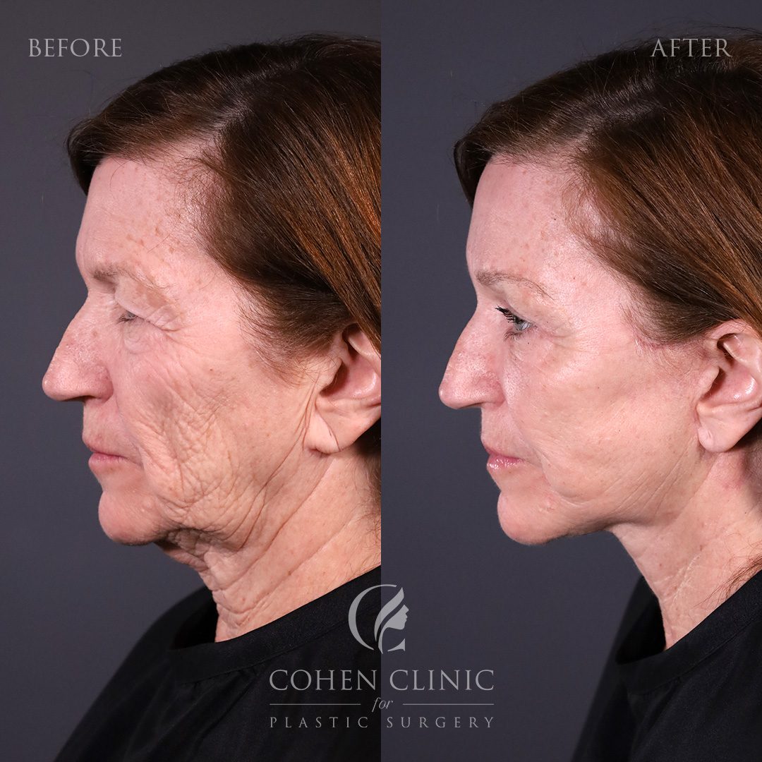 Case 65771 Marge Image