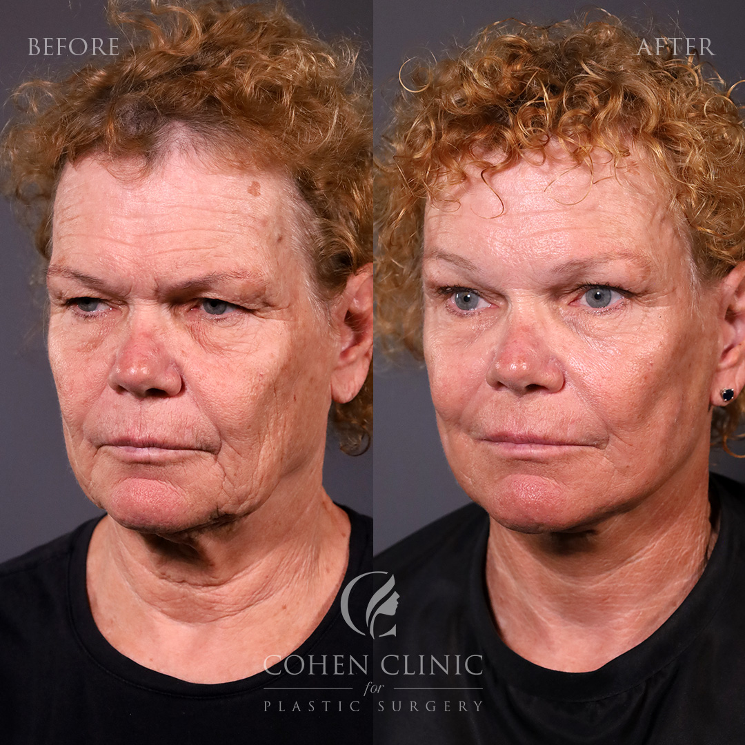 Case 89455 Marge Image