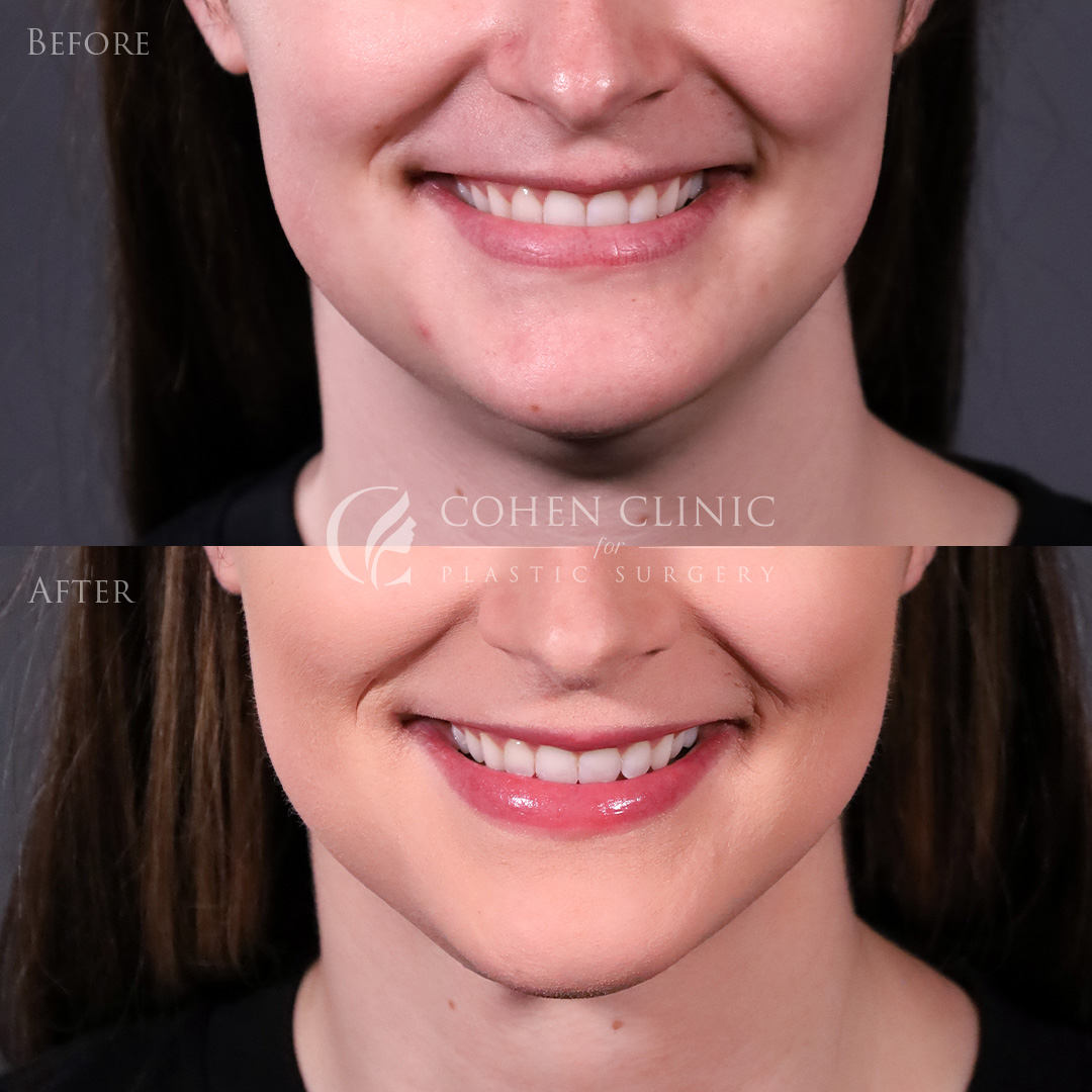 Case 98004 Marge Image