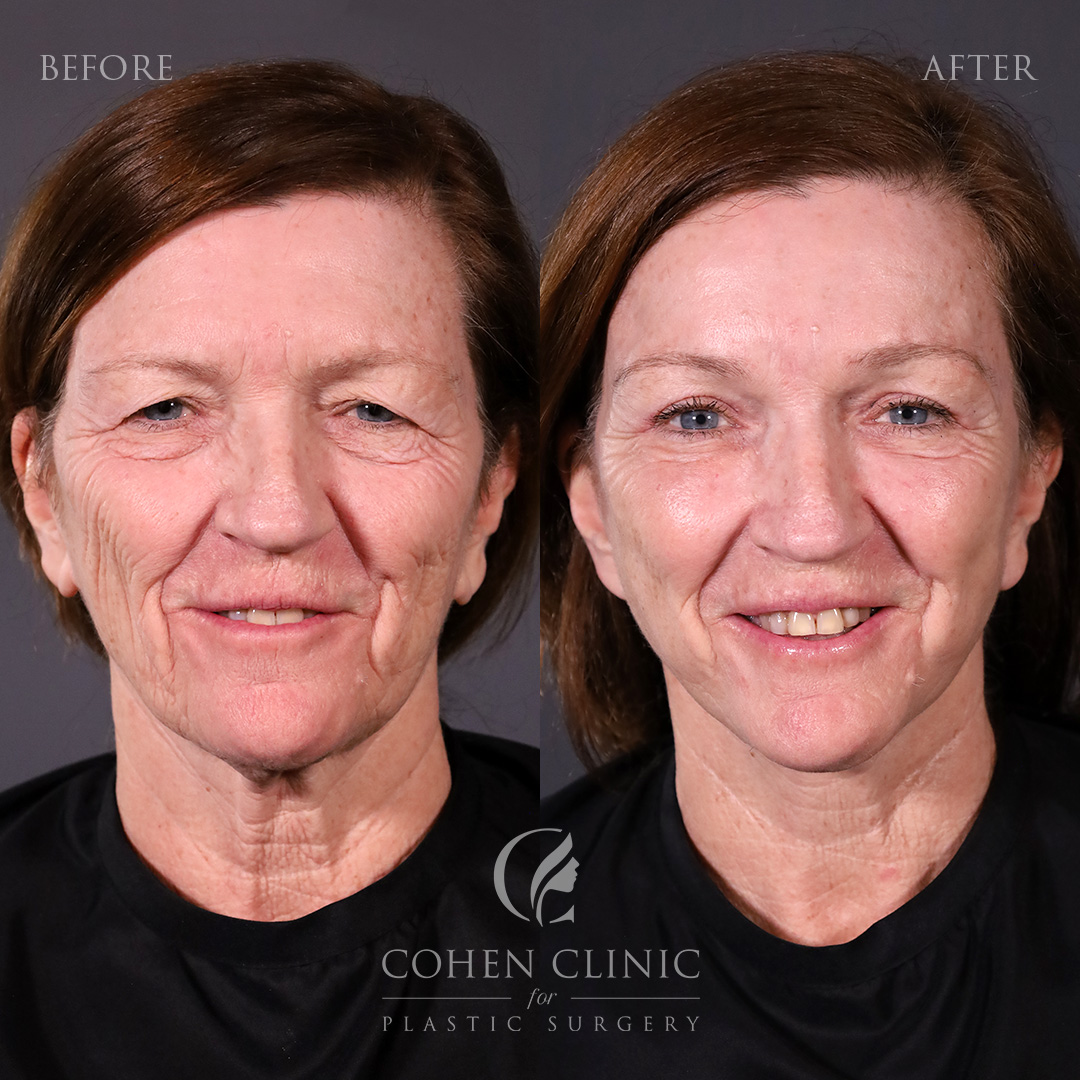 Case 65771 Marge Image