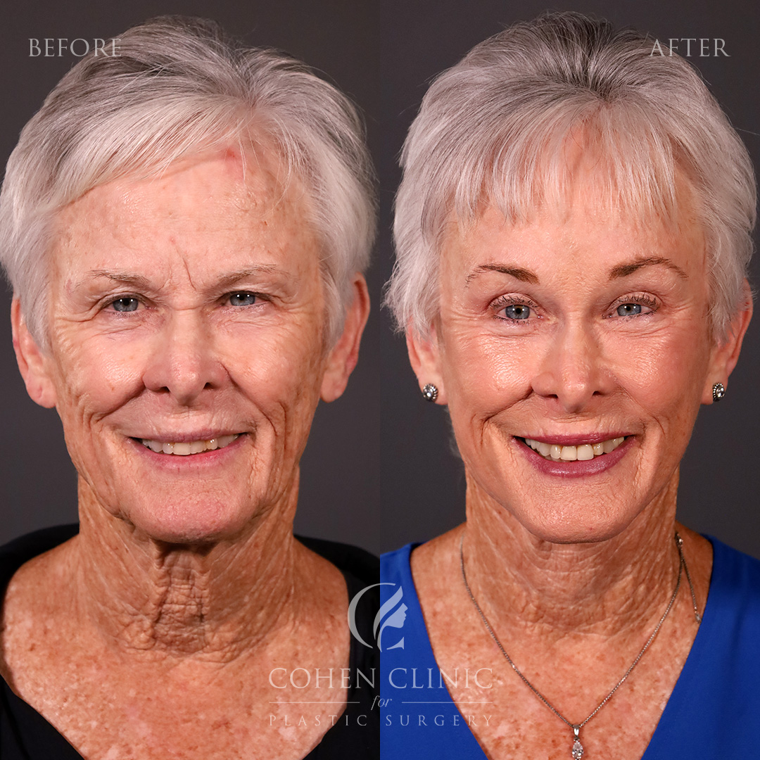 Case 33499 Marge Image