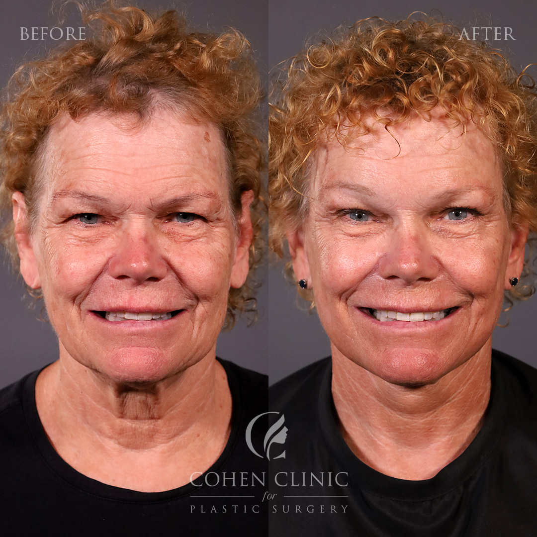 Case 89455 Marge Image