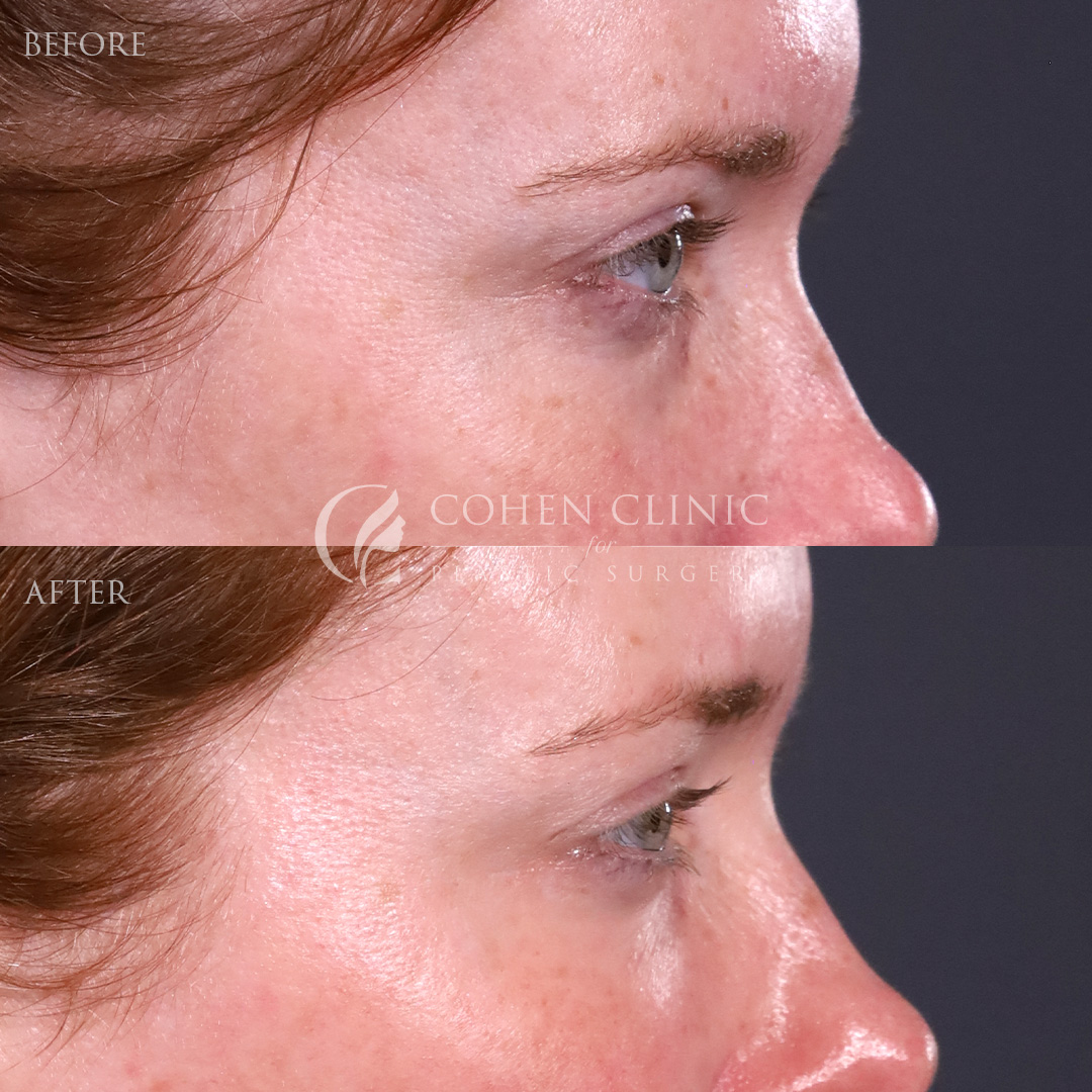 Case 88799 Marge Image