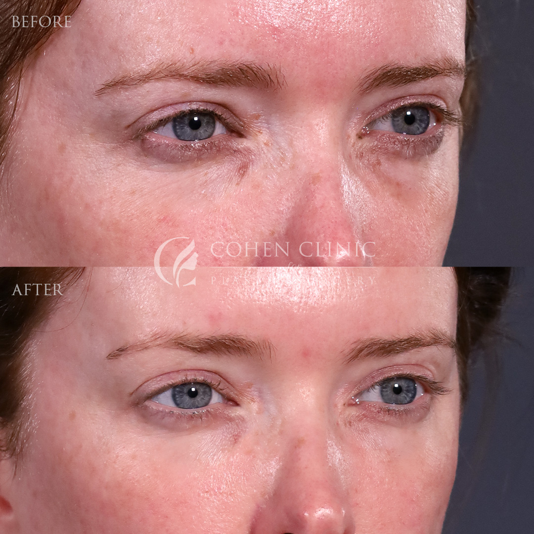 Case 88799 Marge Image