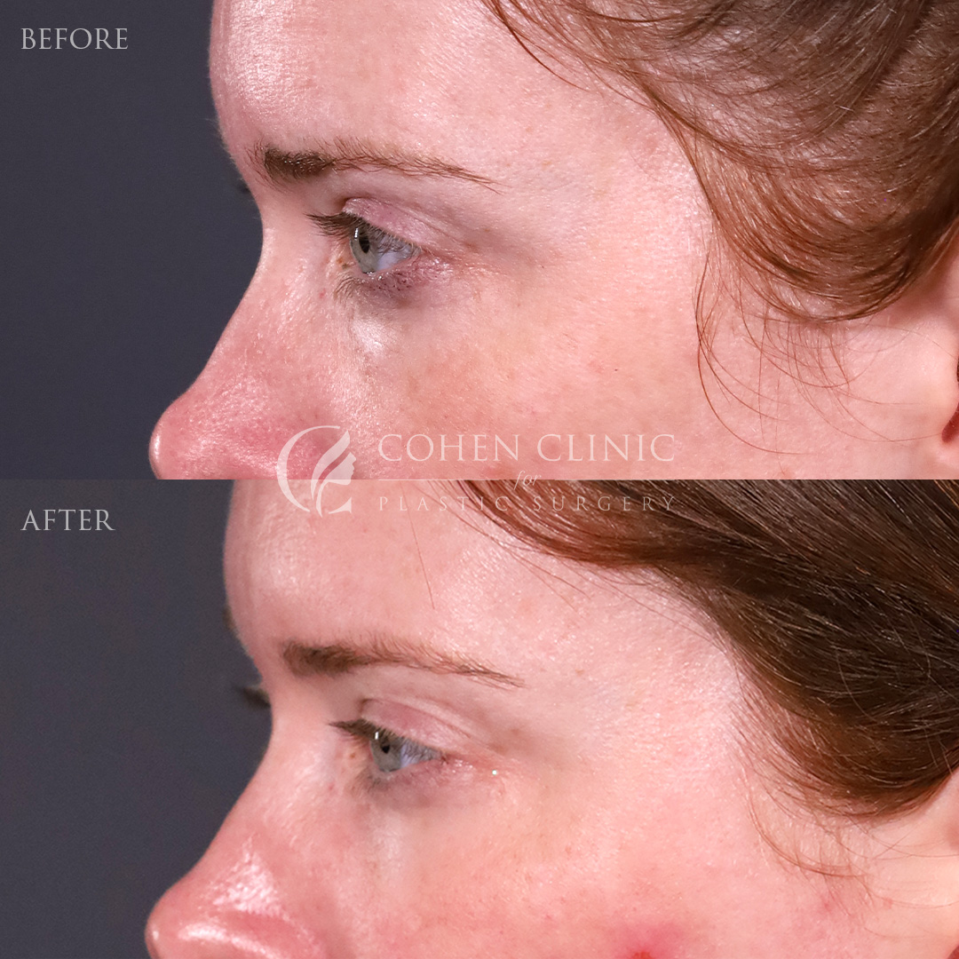 Case 88799 Marge Image