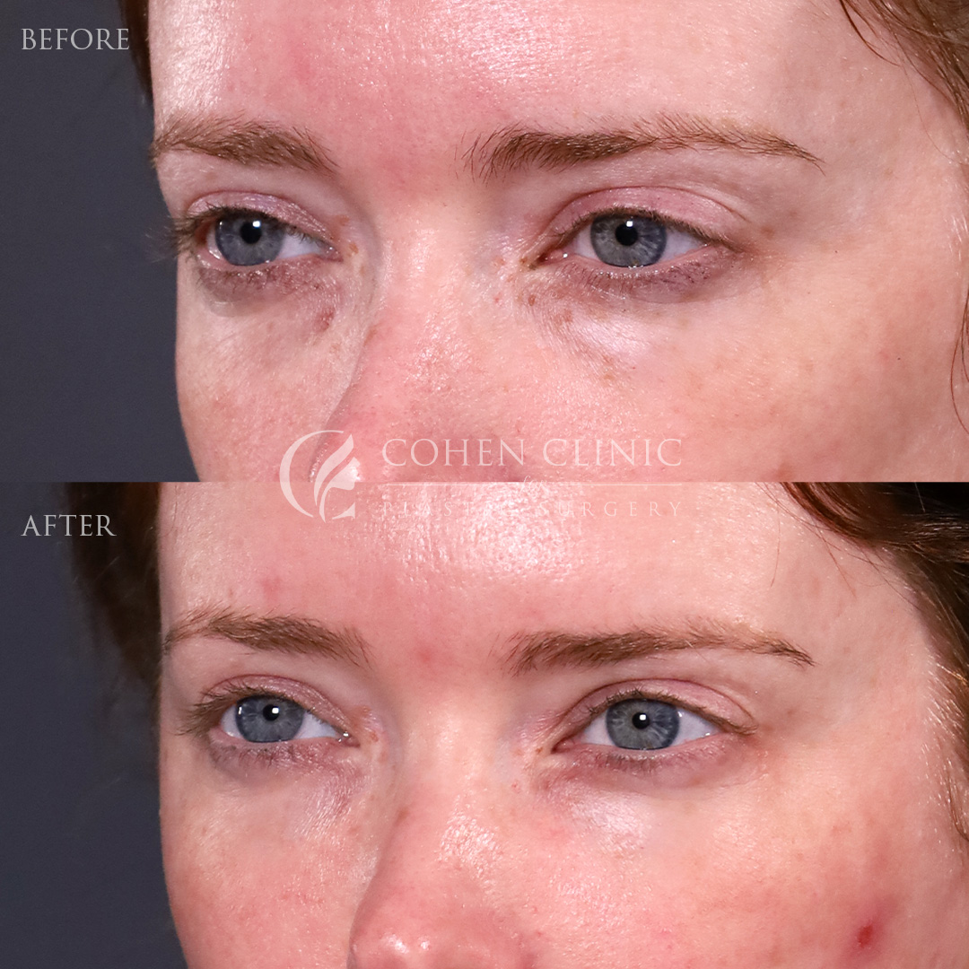 Case 88799 Marge Image