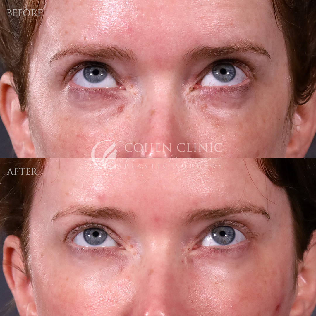 Case 88799 Marge Image