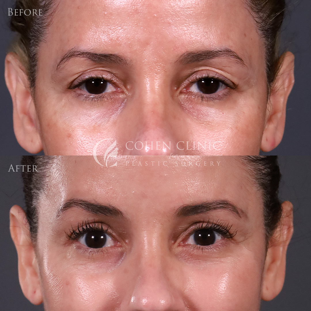 Case 11633 Marge Image