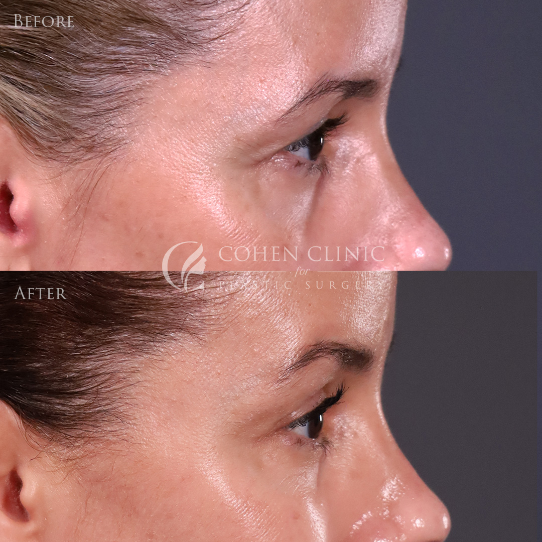 Case 11633 Marge Image