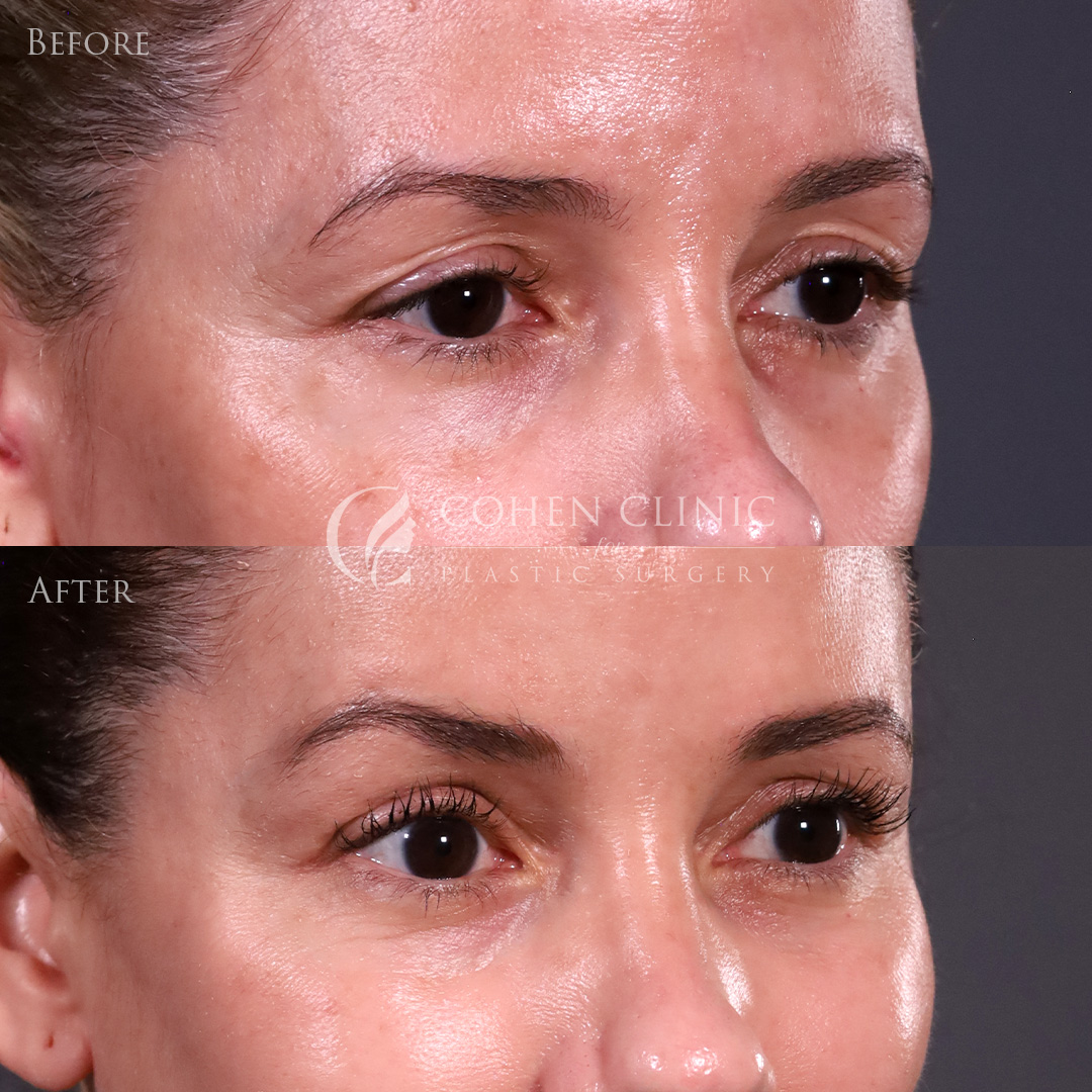 Case 11633 Marge Image