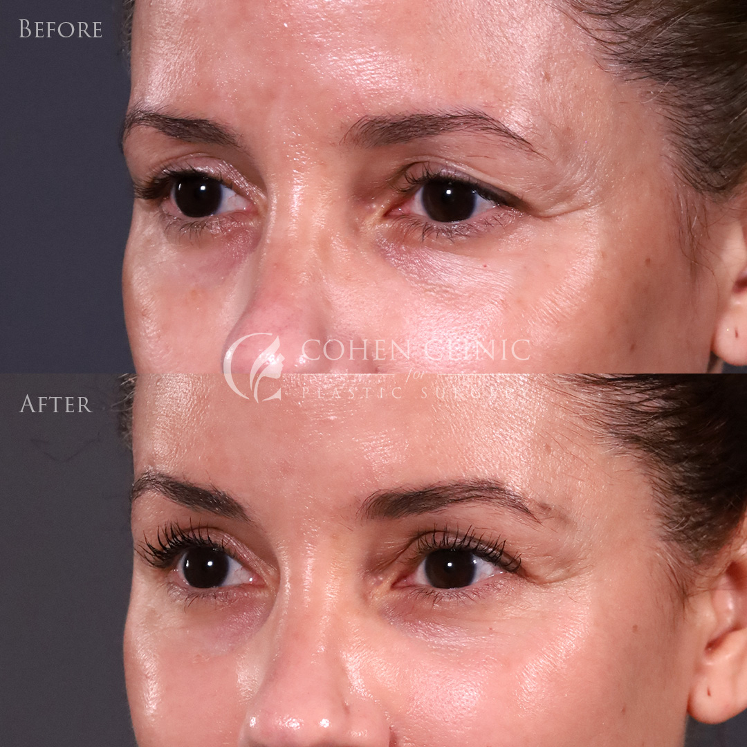 Case 11633 Marge Image