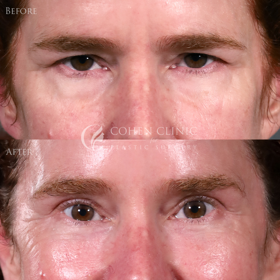 Case 00776 Marge Image