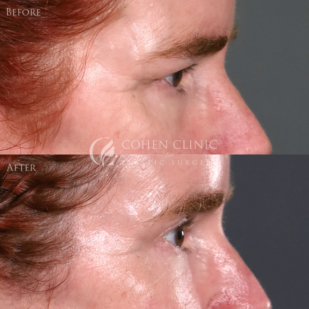 Case 00776 Marge Image