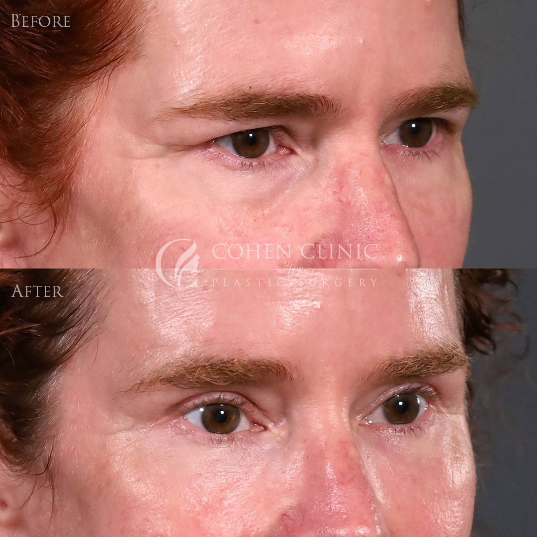 Case 00776 Marge Image