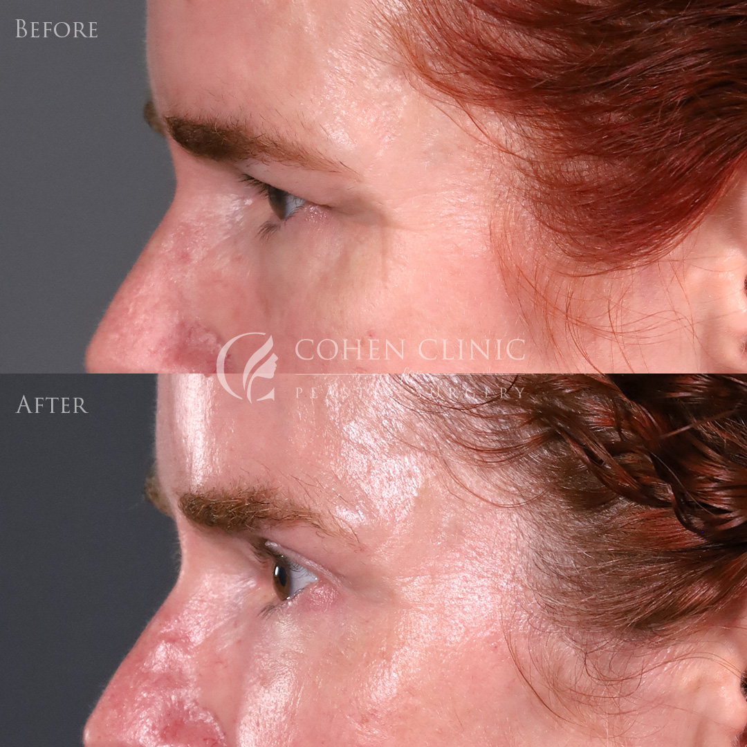 Case 00776 Marge Image