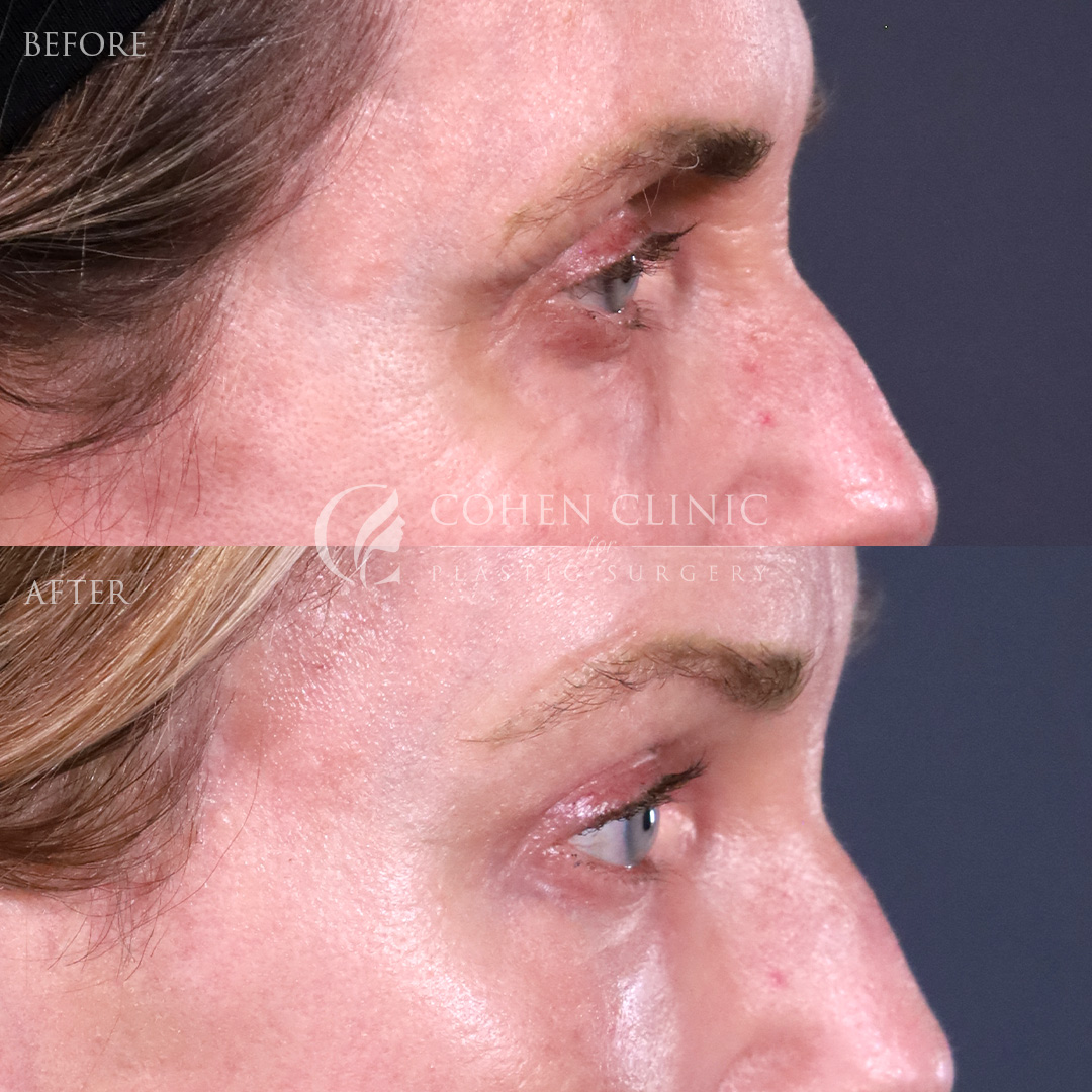 Case 11544 Marge Image